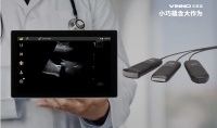 便携式超声正处蓝海，「飞依诺」推出全球首款IPX7防水级别掌上超声