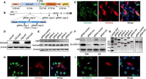 北大团队成功实现精准删除特定记忆,马斯克脑机接口有望今年人体测试