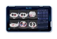 36氪首发丨医疗AI研发商「深睿医疗」完成数亿元C+轮融资，已获批中国创新AI产品NMPA三类证