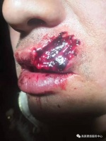 谈谈左贡小志被摩友网暴事件