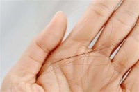 植发生意究竟有多暴利？