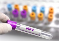 九价HPV疫苗厂商上市接力，亏损7亿多的康乐卫士冲刺北交所丨IPO速递