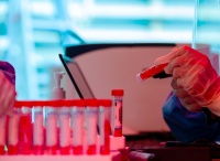 靠新冠检测赚“快钱”的圣湘生物，Q3净利下滑25.59%，但舍得为研发花钱了丨看财报